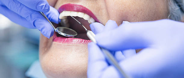 Best Affordable Emergency Dental Care  in Marble Falls, TX